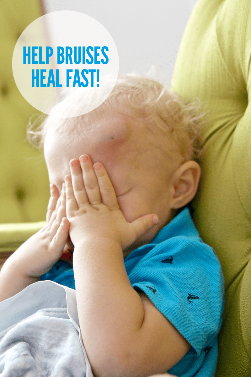 Help for Toddler Bumps & Bruises Paging Supermom