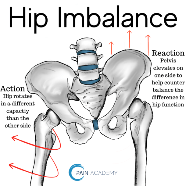 Hip Imbalance Pain Academy