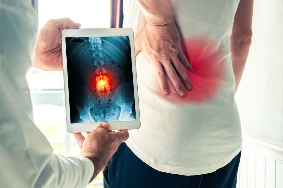 9 Treatments for Failed Back Surgery Syndrome