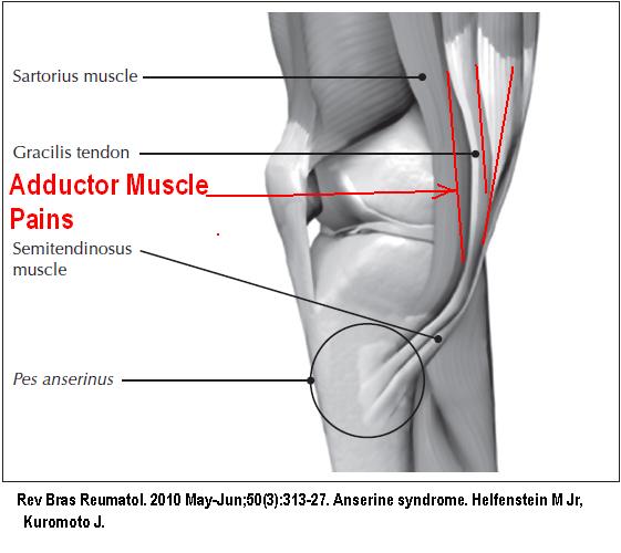 Tissues Around Knee Contribute to Pains Pain Medical Musing