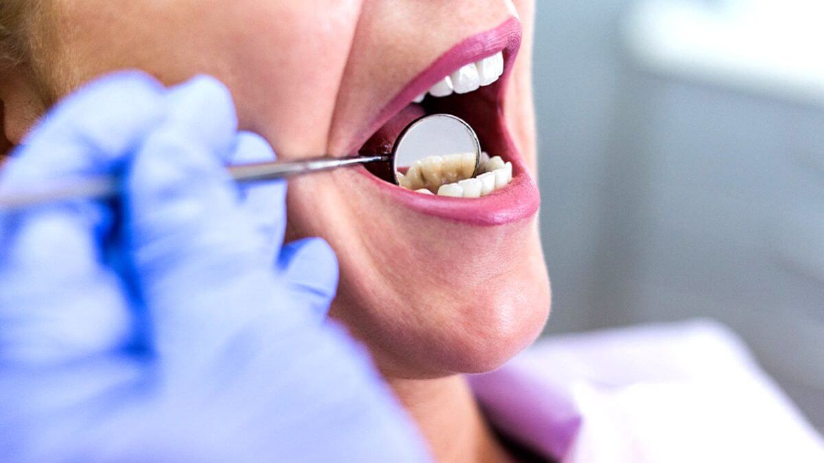 Can Wisdom Teeth Cause Neck Pain? Is There Any Connection?