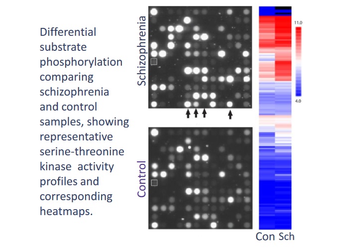 Kinase Activity Profiling Services Pamgene