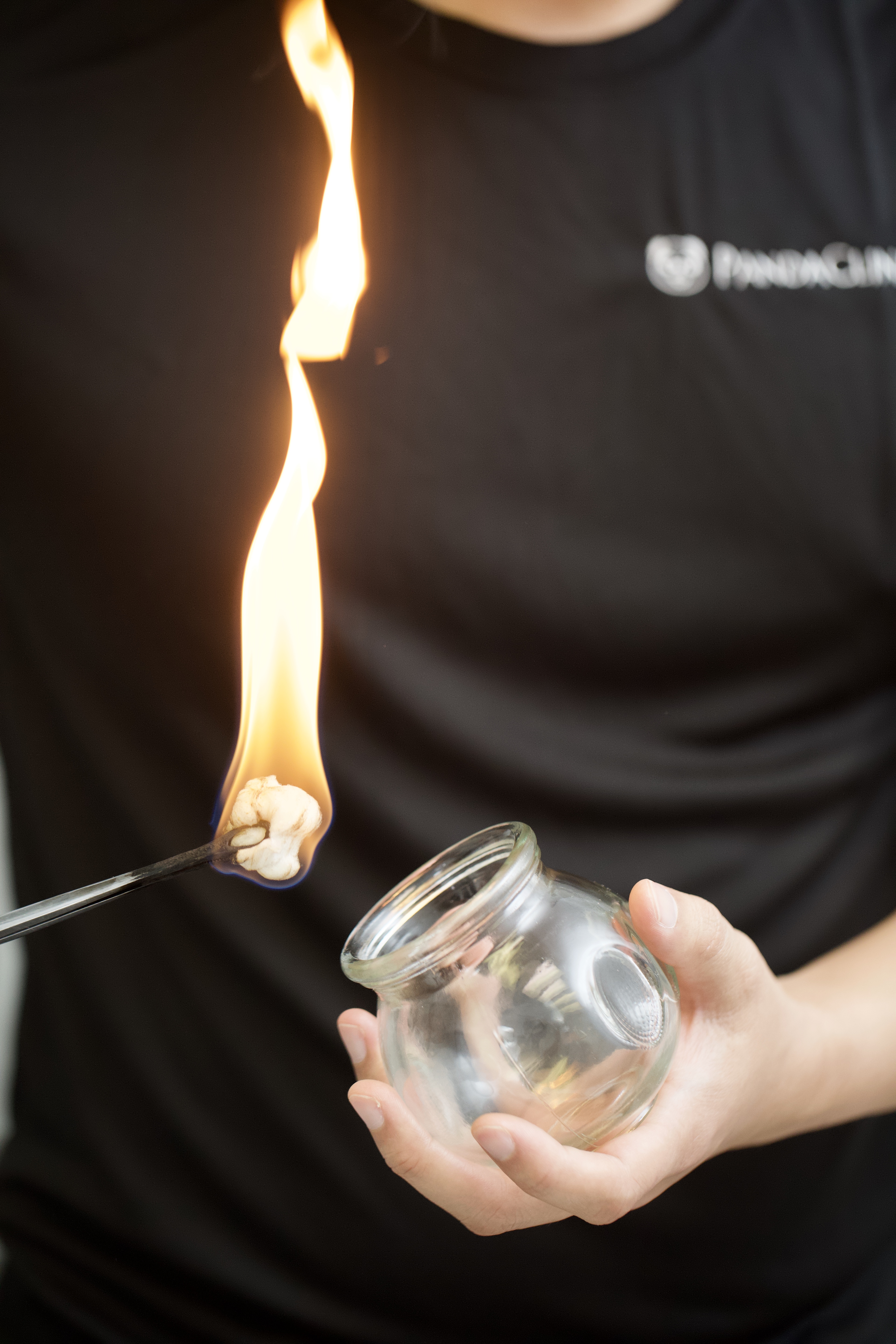 Cupping Therapy Panda Clinic