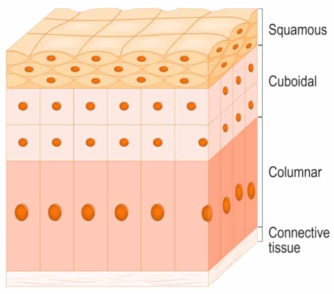 Epithelial Cell Abnormality All You Need To Know