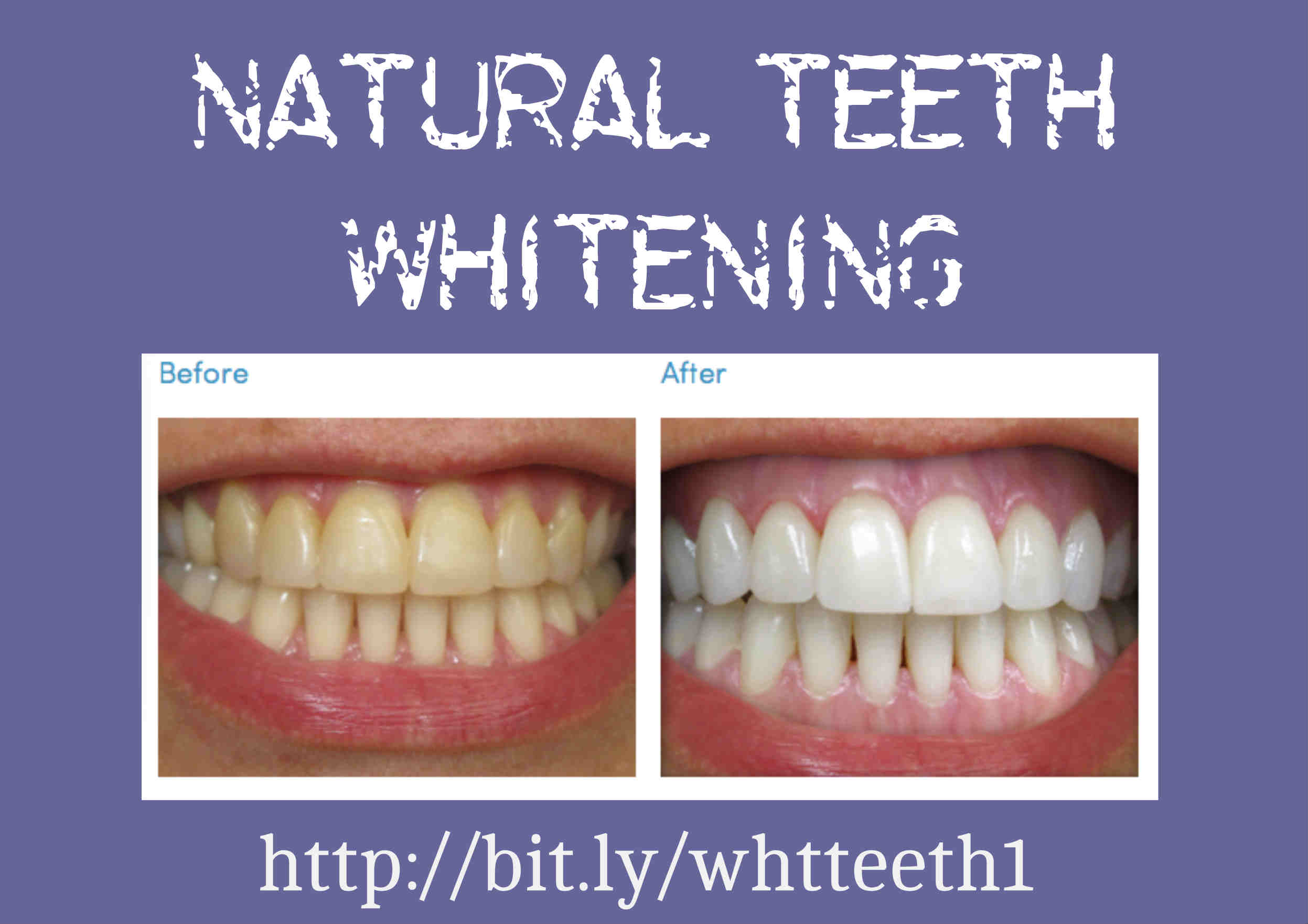Natural Teeth Whitening – Skai Juice