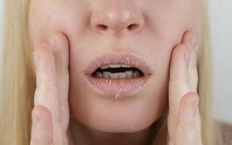 Lips Exfoliation Best ways to get rid of dead skin cells on lips