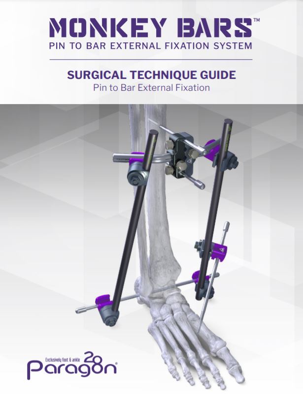 Monkey Bars™ Pin to Bar External Fixation System Paragon 28