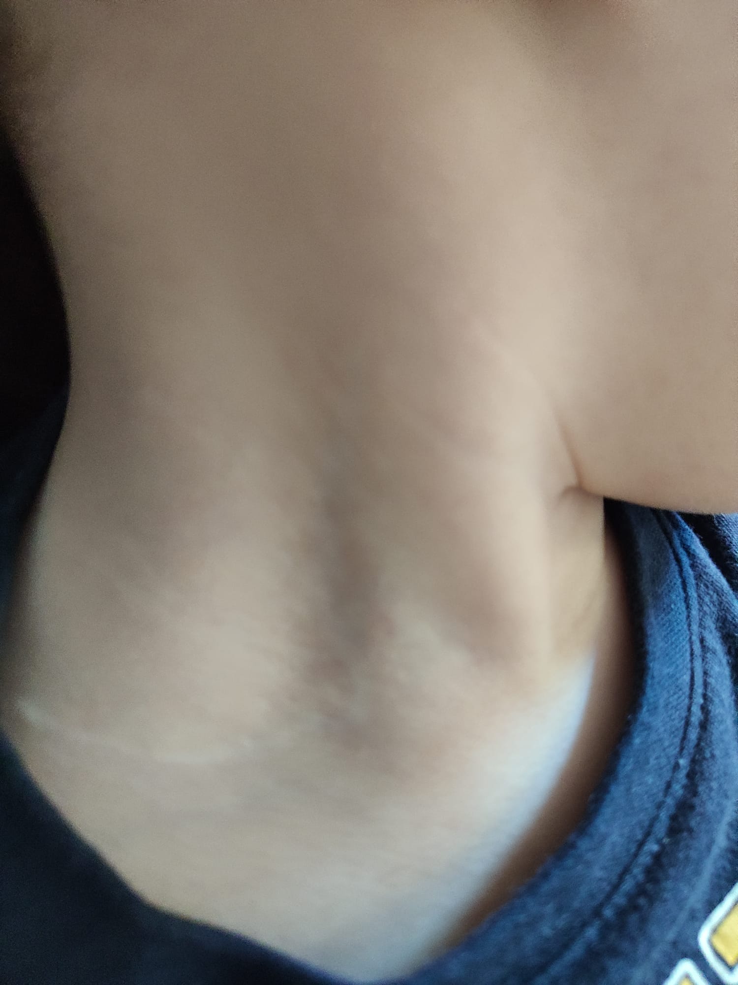 Cicatrices PBO