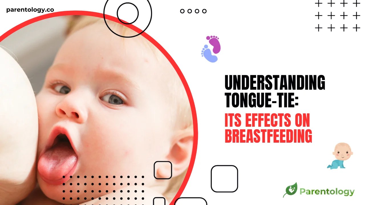 What Is Tongue Tie In Babies Its Effects on Breastfeeding