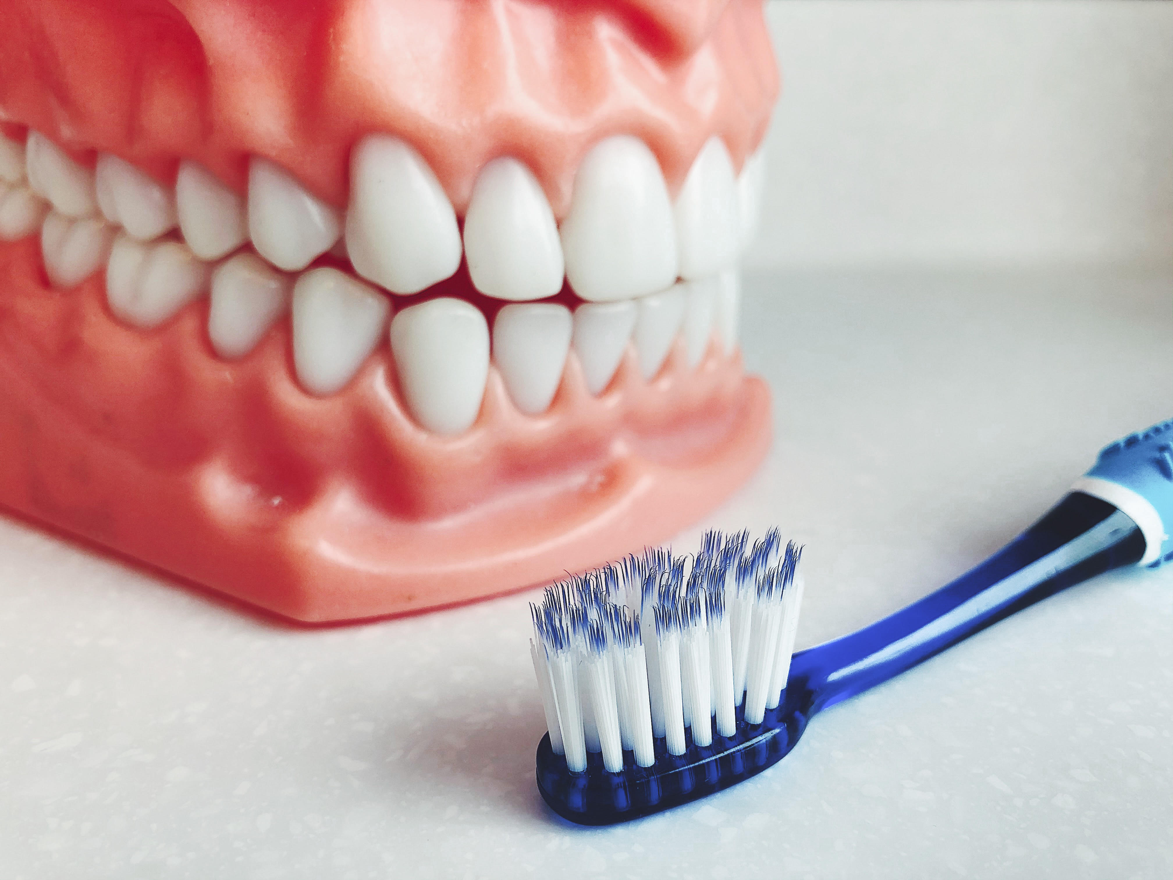 The sulcular brushing PARO IMPLANTO PointeClaire