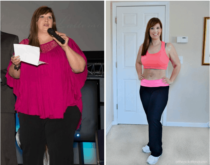 25 Lb Weight Loss Before And After Weight Loss Wall