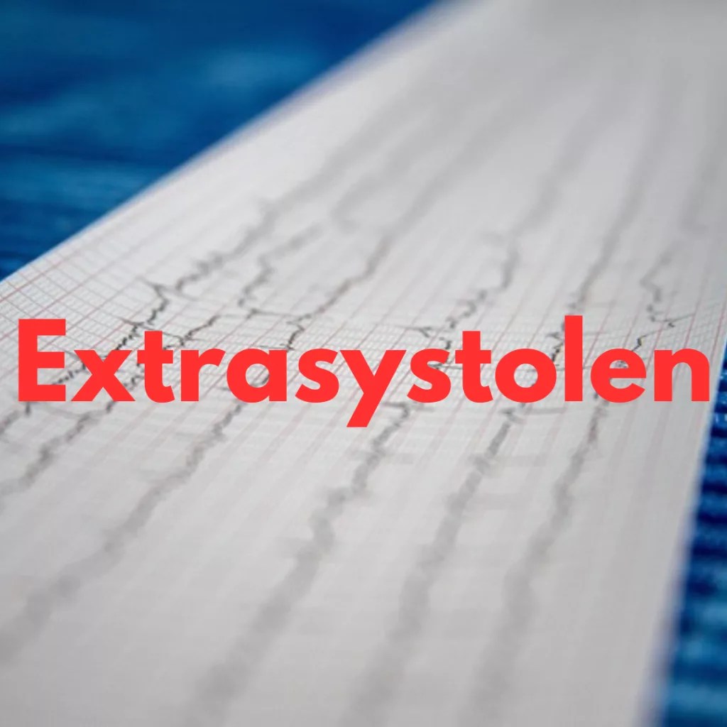 Extrasystolen verstehen Alles über Ursachen und Behandlung