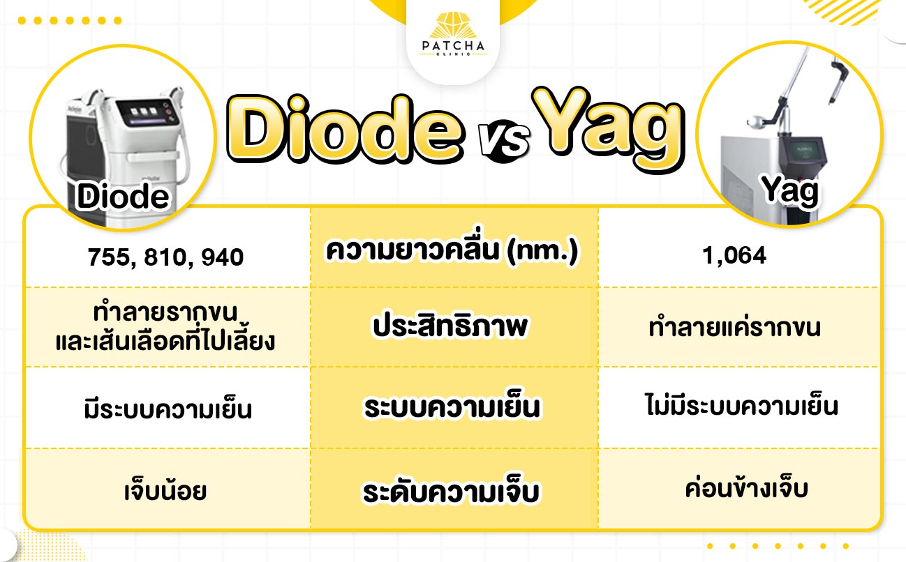 กำจัดขนด้วย Diode laser ดีไหม บอกลาเส้นขนอย่างถาวรได้จริงไหม