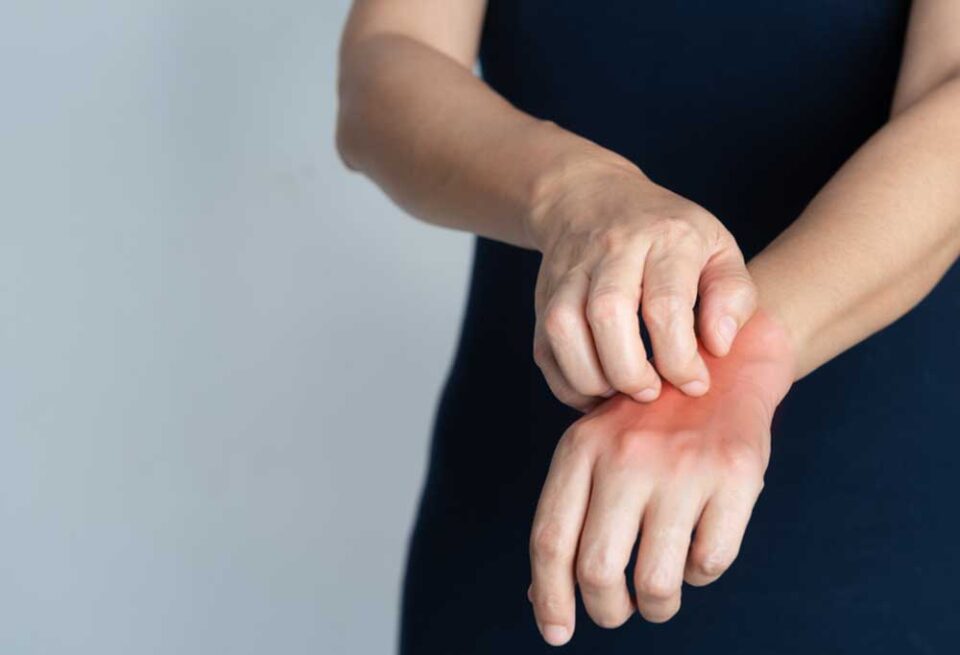 How to Keep Fleas Off Humans?