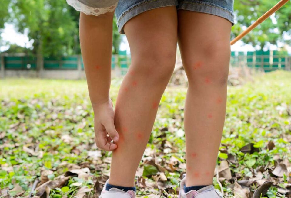 Does Deet Repel Fleas