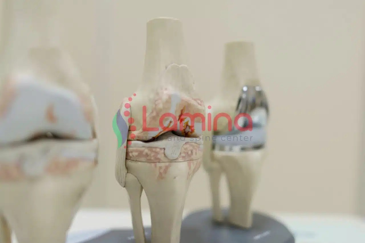 Obat Pengapuran Lutut Itu Apa? Viscoluplemen Jadi Solusi » Klinik Patella