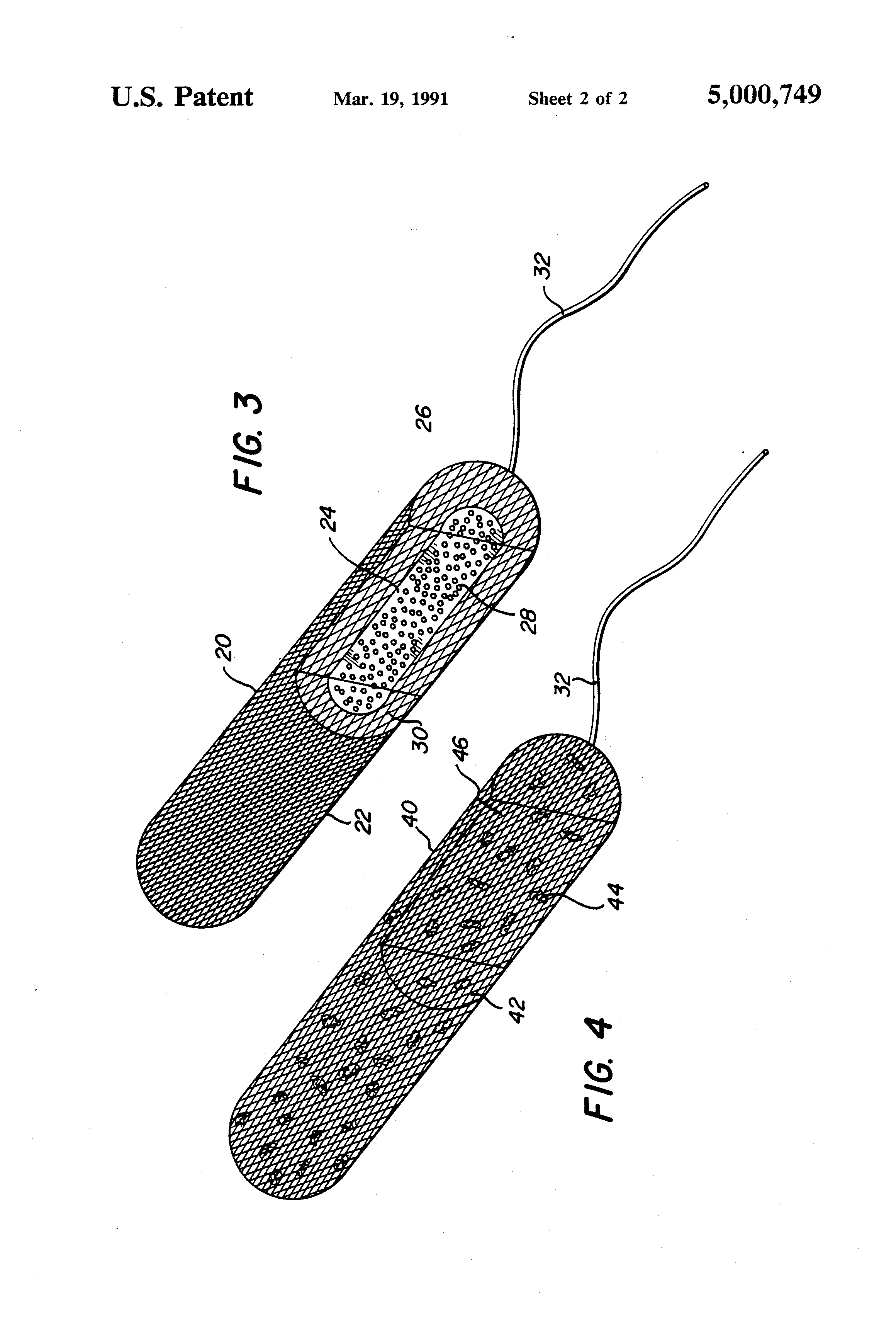 Patent US5000749 Iodine contraceptive sponge Google Patents