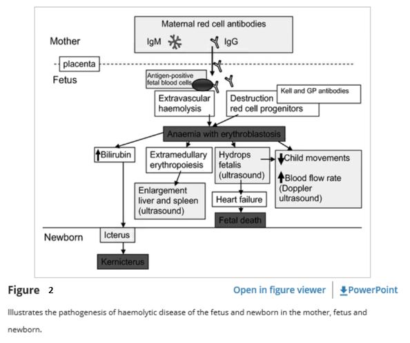 Case 1066 Transfusion Pathology Case