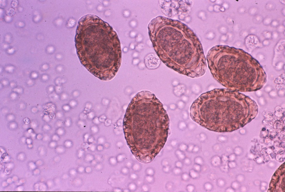 Giant Kidney Worm Pathology and Ponies