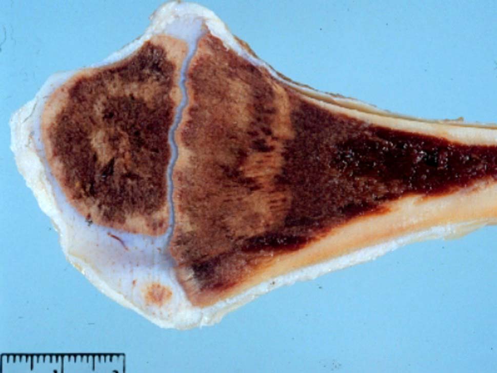 Marble Bone Disease Pathology and Ponies