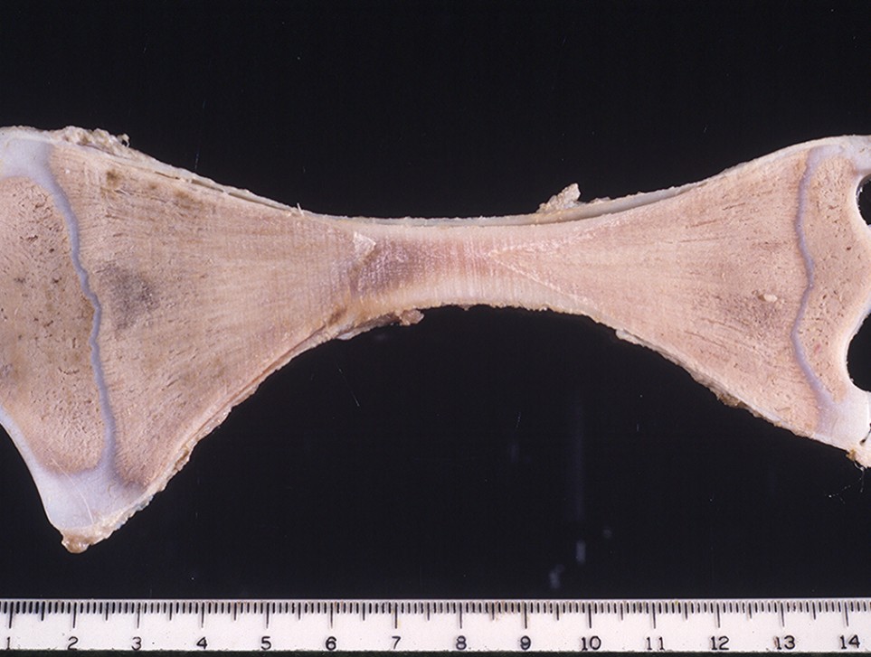 Marble Bone Disease Pathology and Ponies