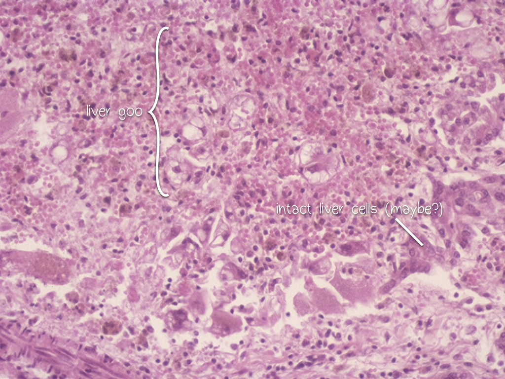 Theiler's Disease Pathology and Ponies