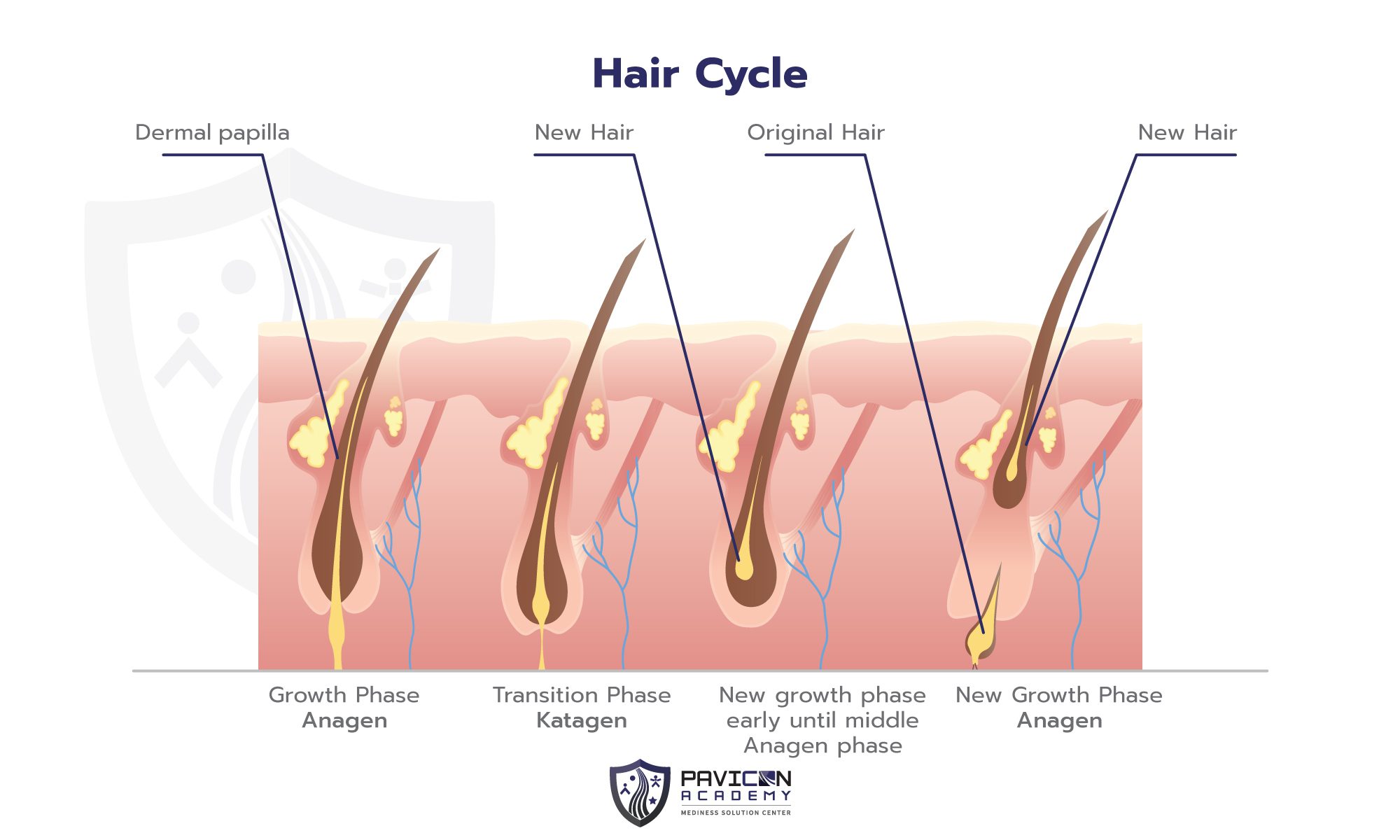 Hair Loss Guide Pavicon Mediness Center