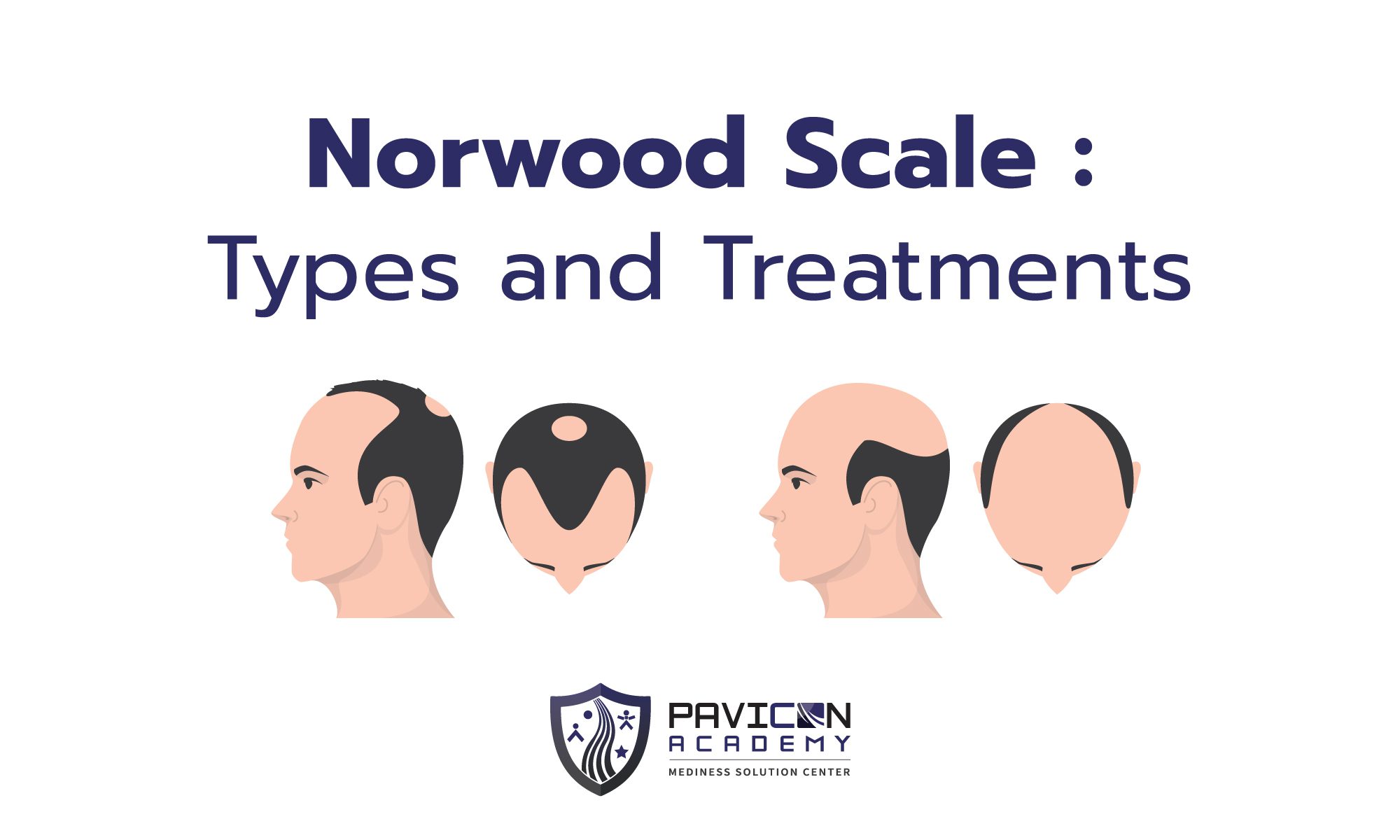 Norwood & Hamilton Scales Pavicon Mediness Center