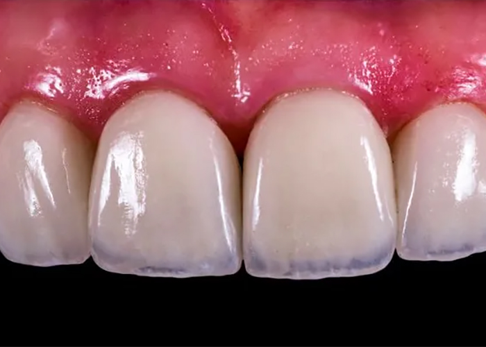 PB Lab Dental Laboratory