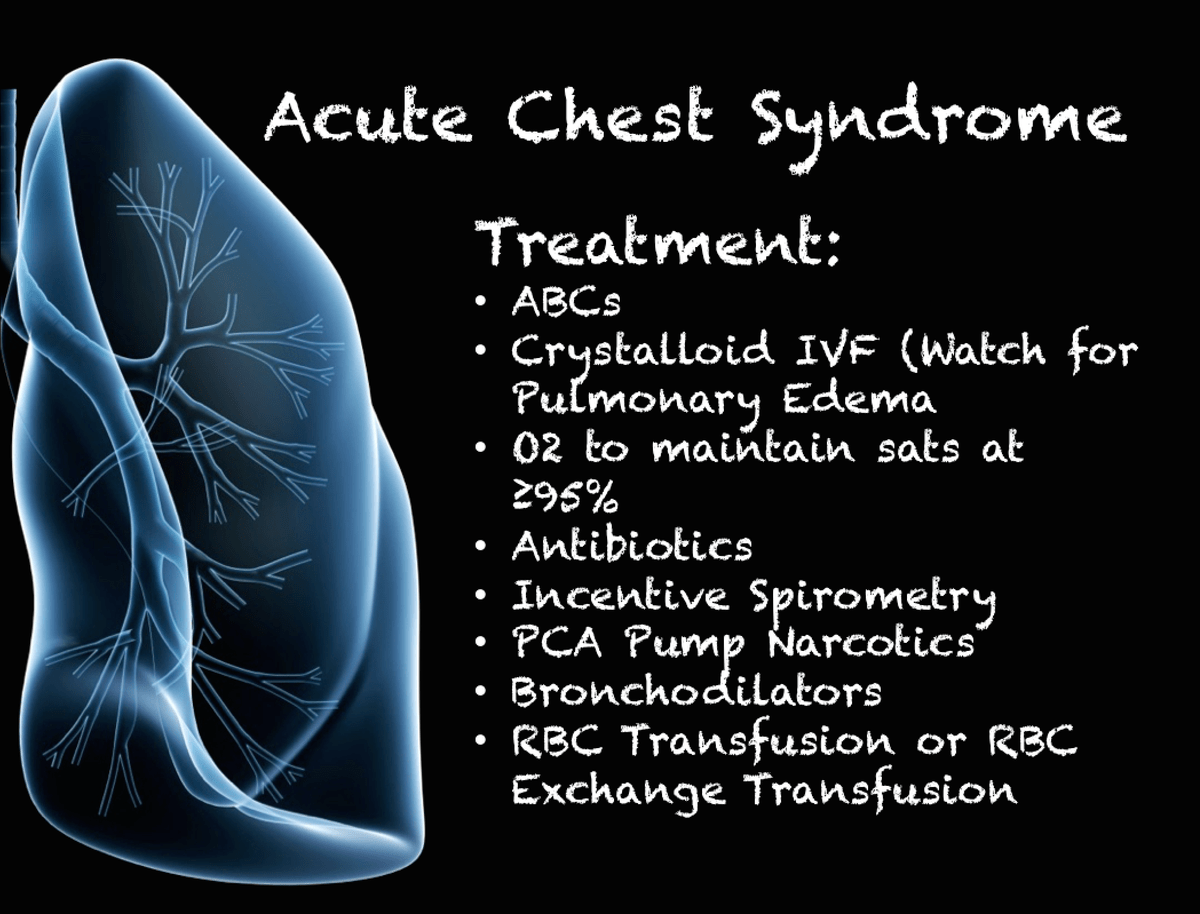 Acute Sickle Chest Syndrome – Sickle Cell Acute Chest Syndrome – YYDDL