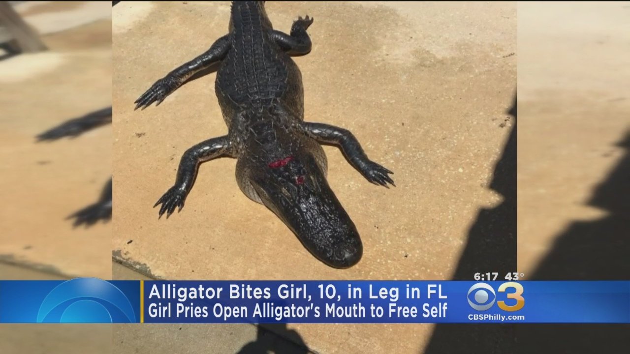 Girl, 10, Frees Herself After Alligator Bites Her Leg At Florida Park