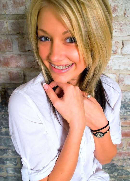 Girls With Braces on Twitter "braces girlswithbraces https//t.co