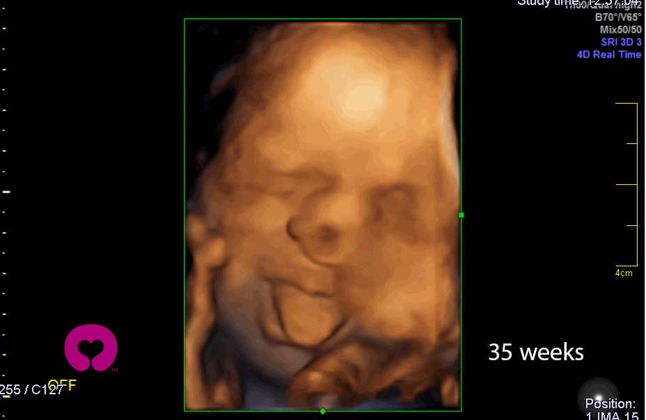 Estimula a tu bebÃ© antes de nacer con el dispositivo de mÃºsica Babypop