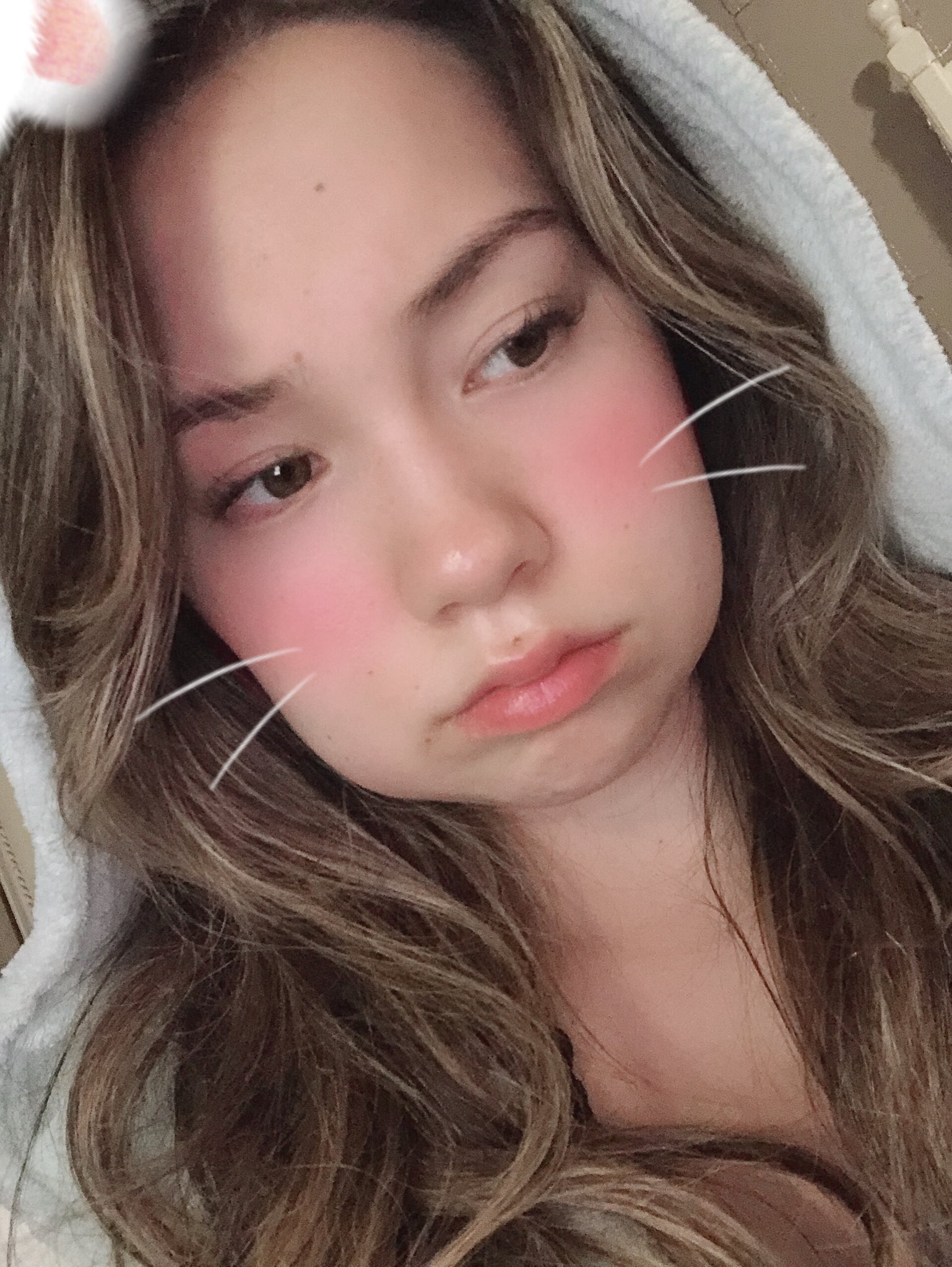 QuarterJade on Twitter "If you’re wondering how my recovery is going