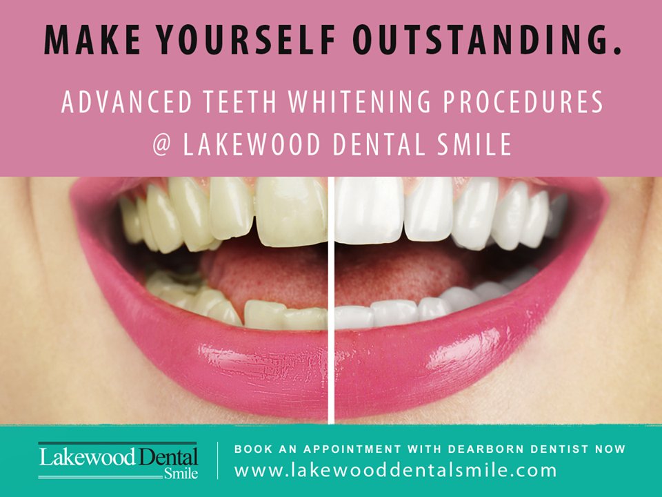 Lakewood Dental Smile (LDentalSmile) Twitter