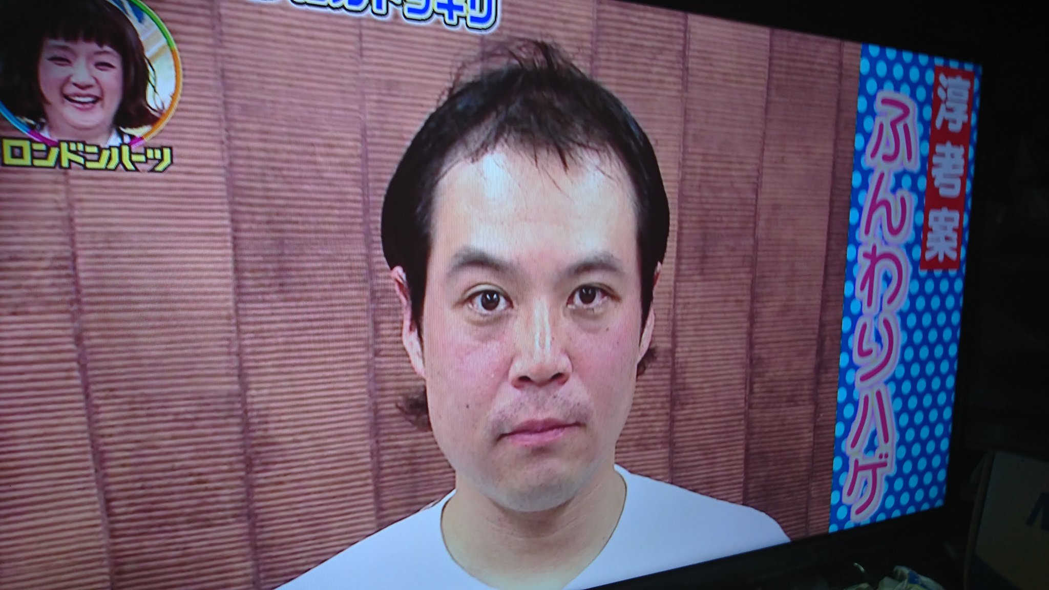 画像 衝撃タカアンドトシのタカがハゲを告白 https//t.co/6GNHMMGyH3。 まとめダネ！