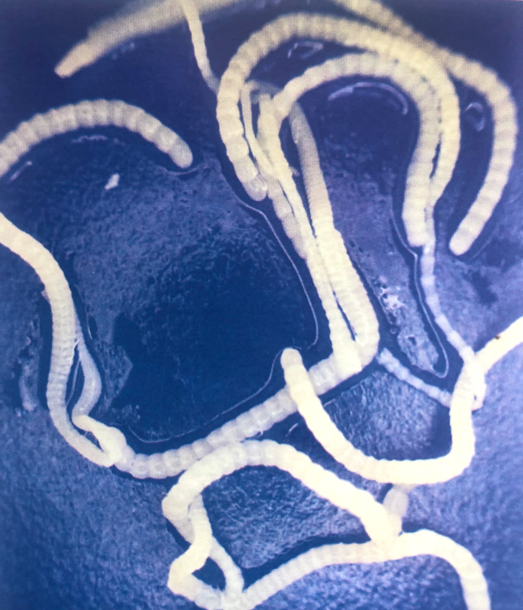 Avivets on Twitter tapeworm in chickens, Raillietina