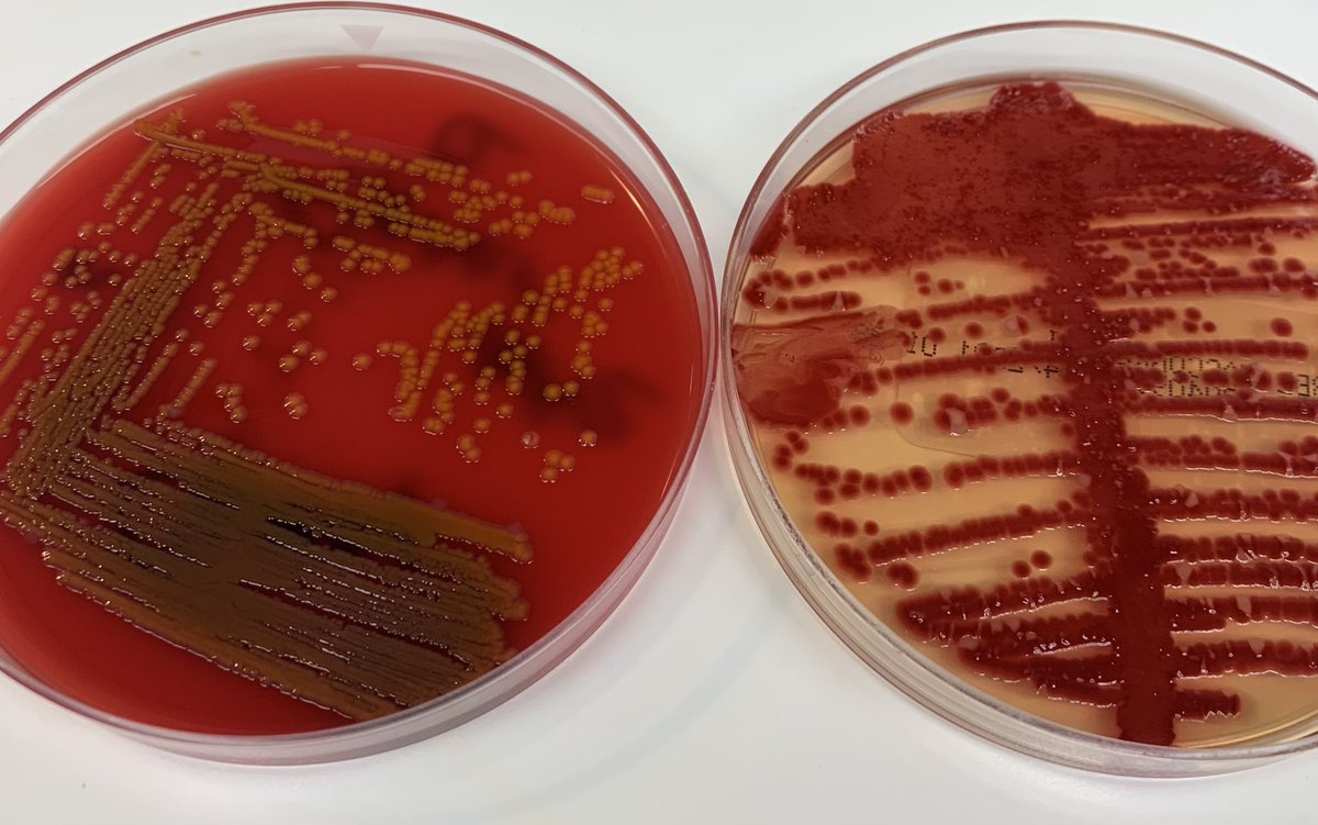 Serratia Marcescens On Macconkey Agar