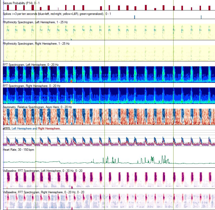 Uf Calendar 2023 Summer University Of Florida Epilepsy Program (@Ufepilepsy) / Twitter