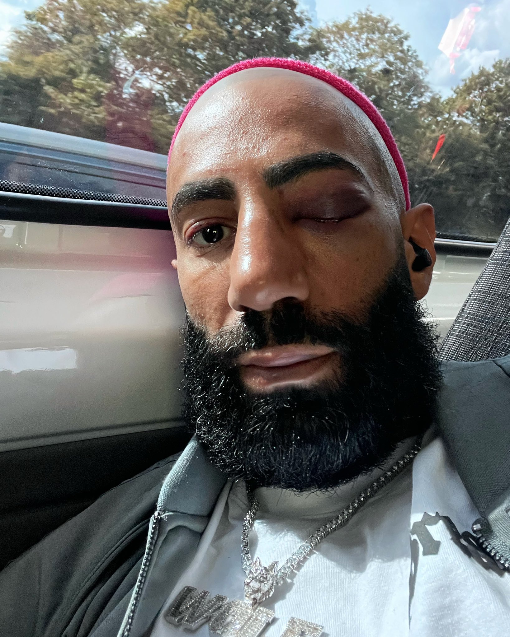 fousey on Twitter: "I was going to keep this private.. 🐺 https://t.co