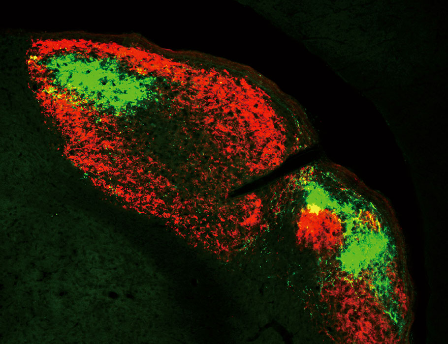 Science Magazine on Twitter "Why does green light relieve pain in