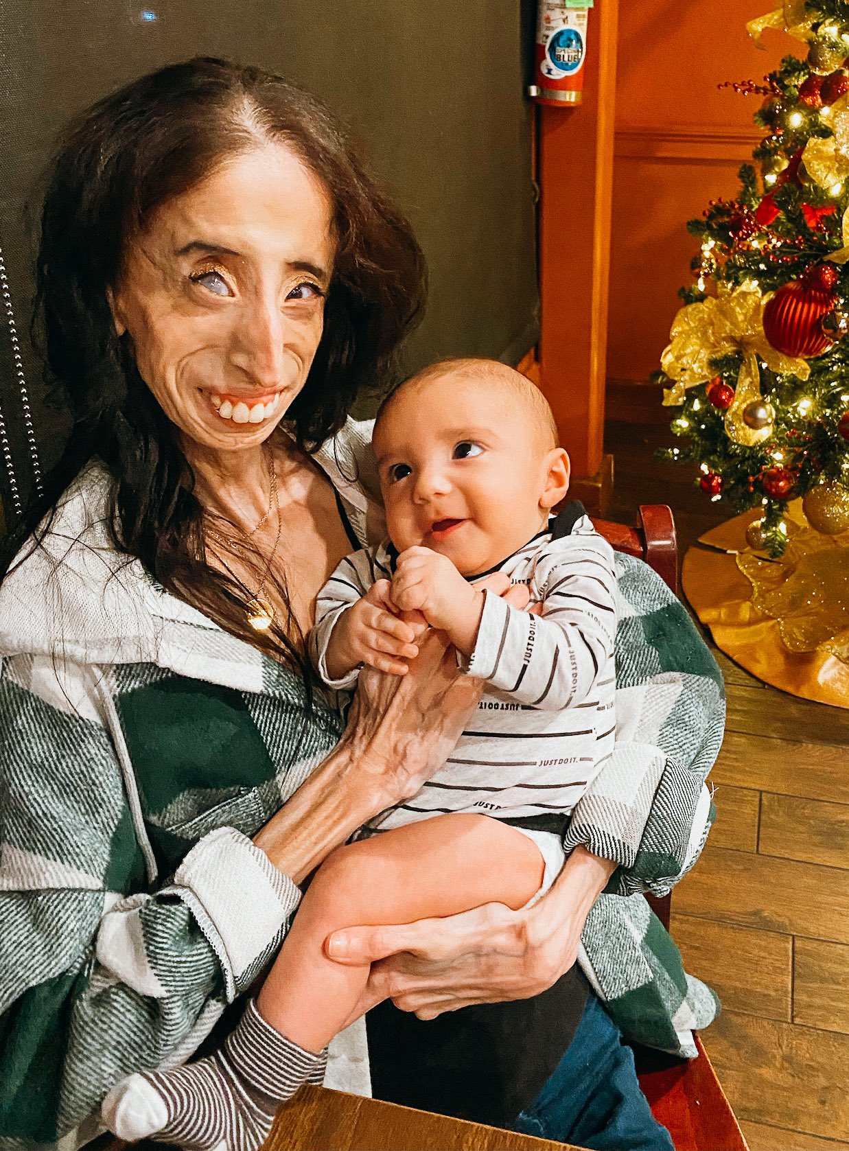 Lizzie Velasquez Before And After