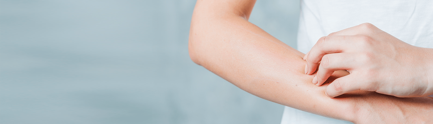 Skin Problems | Kencare Holdings (Singapore)