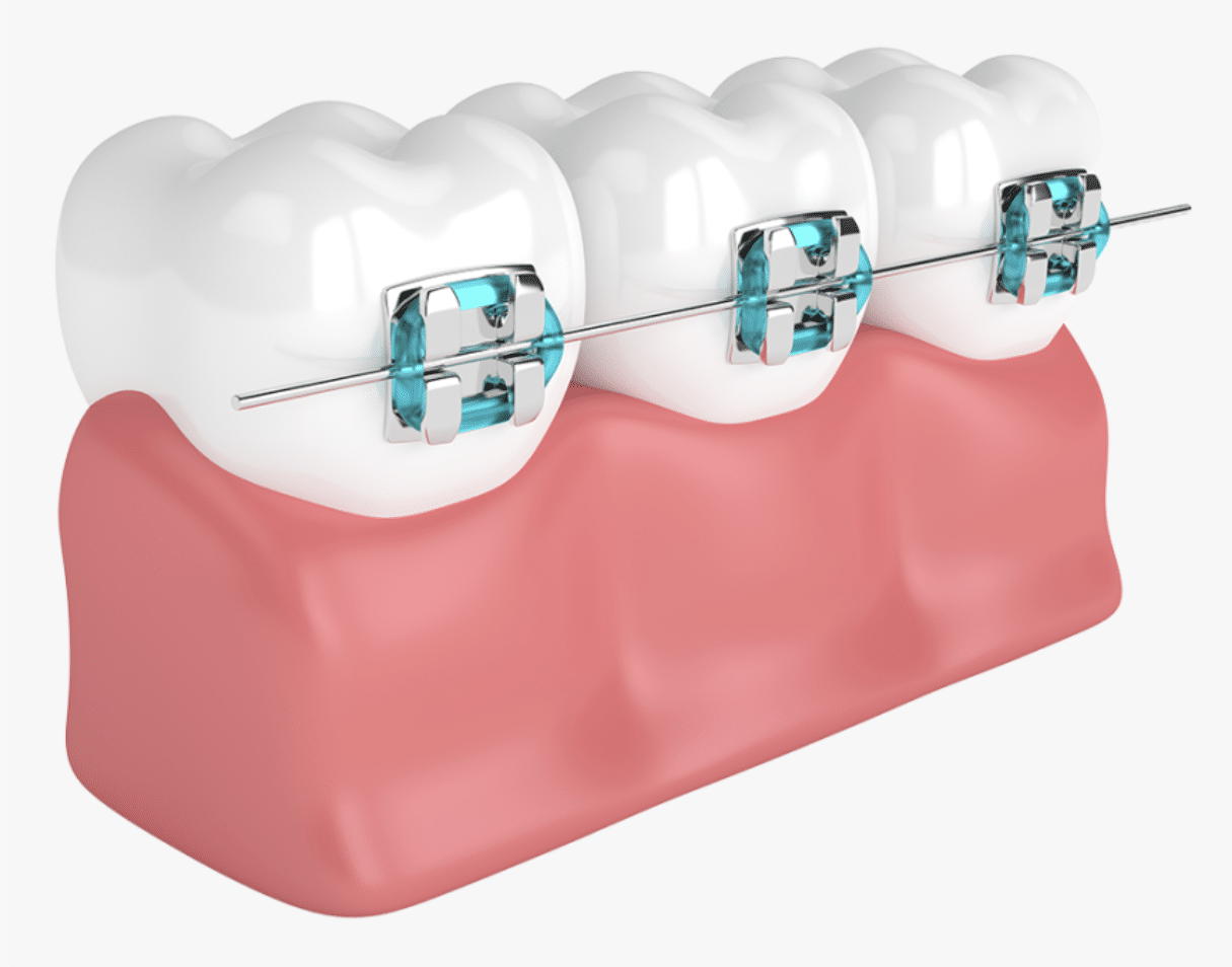 Pediatric Dentist Queens Queens Orthodontist PCO Dental