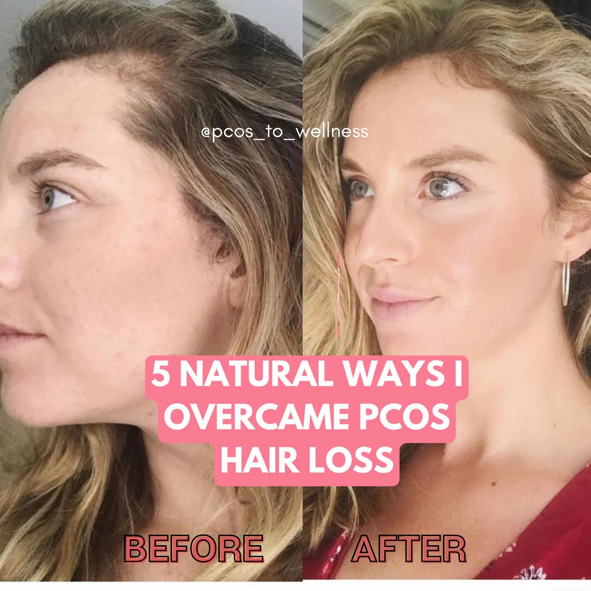 PCOS to Wellness PCOS Advice for Healing Your Condition Naturally