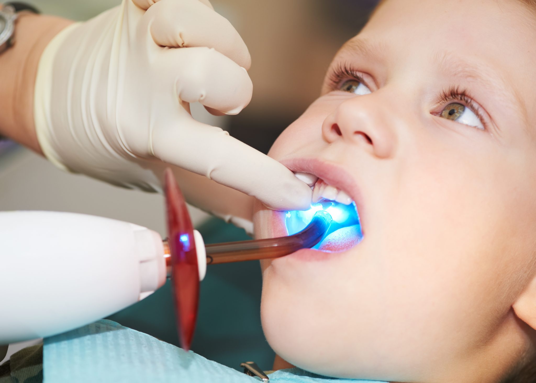 Creating Safe Fillings For Kids With Cavities Dallas, TX