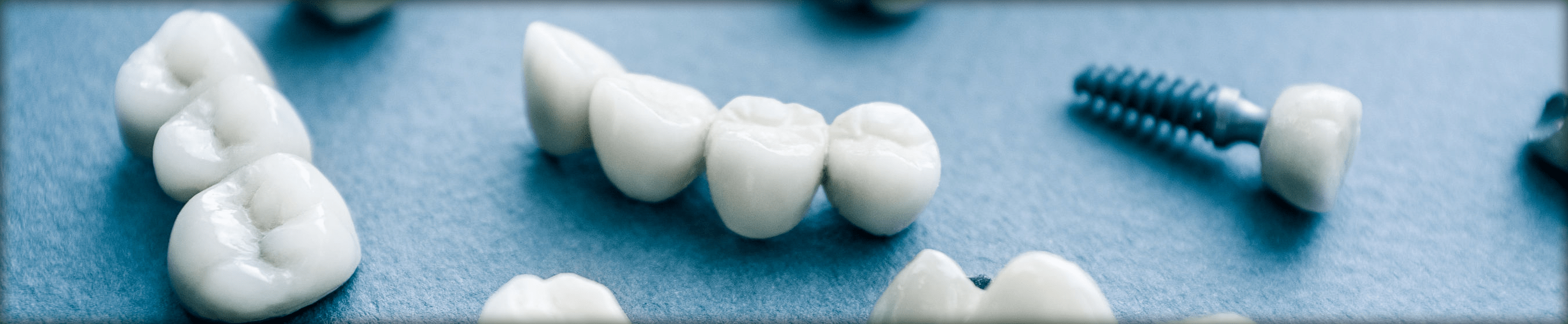 PDL Precision Dental Laboratory