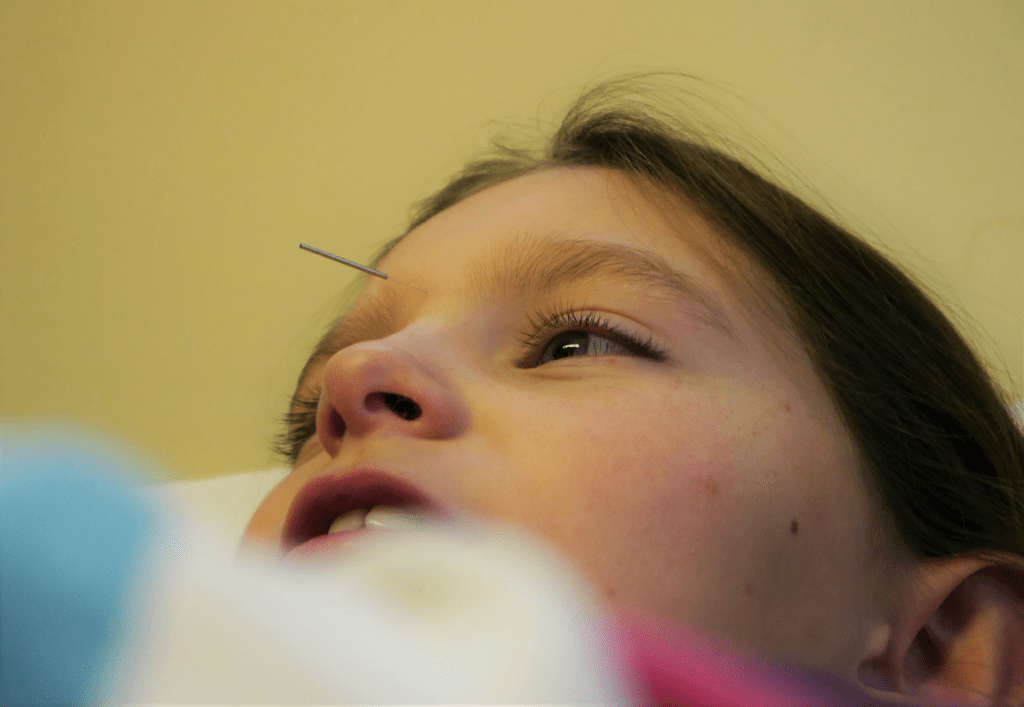 Acupuncture for children and teenagers Peachy Acupuncture