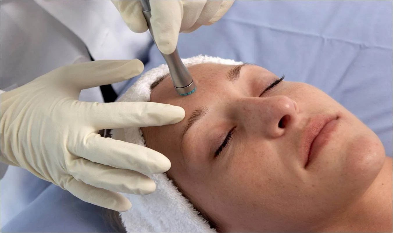 Chemical Peels vs Microdermabrasion Peak Day Spa