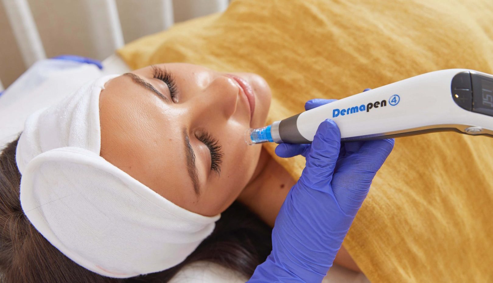 Dermapen Brisbane & Gold Coast Skin Needling